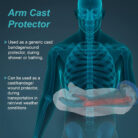 C19-Cast-Cover-(Arm)-2