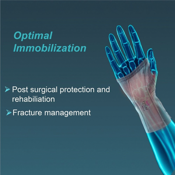 E01-Elastic-Wrist-Splint-Left-Right-2 E01-Elastic-Wrist-Splint-Left-Right-2